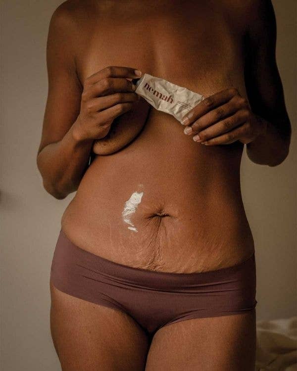 Revitalizing Stretch Mark Cream - IDYLL MANOR